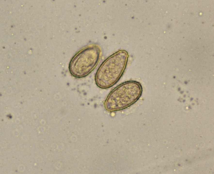 Le complot pour les parasites